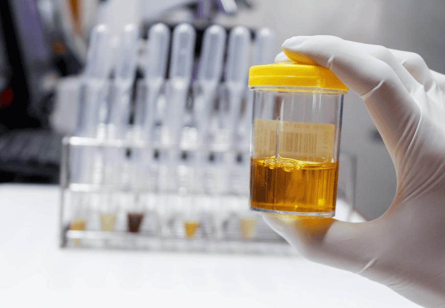 How Long Do Drugs Show on a Urine Test